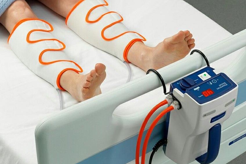 Intermittent Pneumatic Compression Devices for DVT Prevention